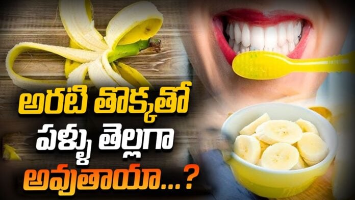 Teeth Whitening With Banana Peel