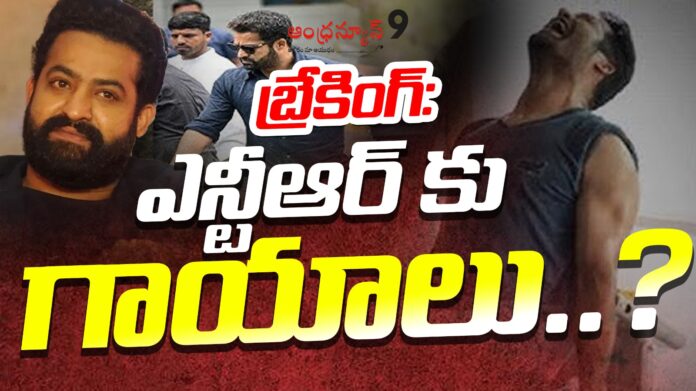 injuries-to-young-tiger-ntr-andhranews9