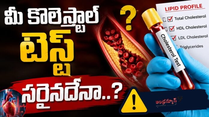Lipid Profile Test For Cholesterol